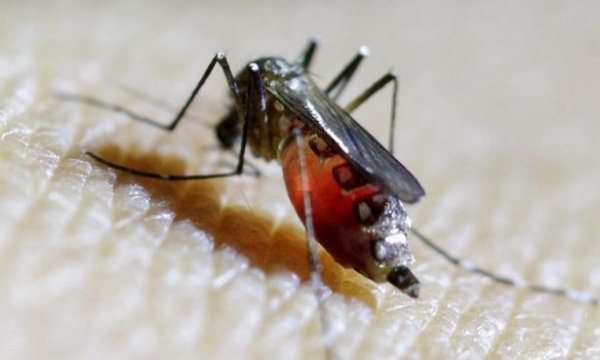 Virus Zika có thể gây rối loạn thần kinh nghiêm trọng